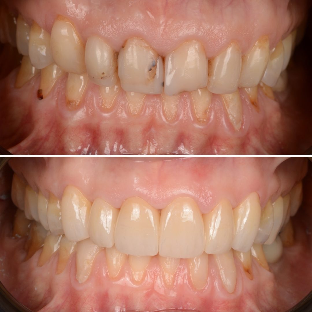 Metodo Aura prima e dopo (1)