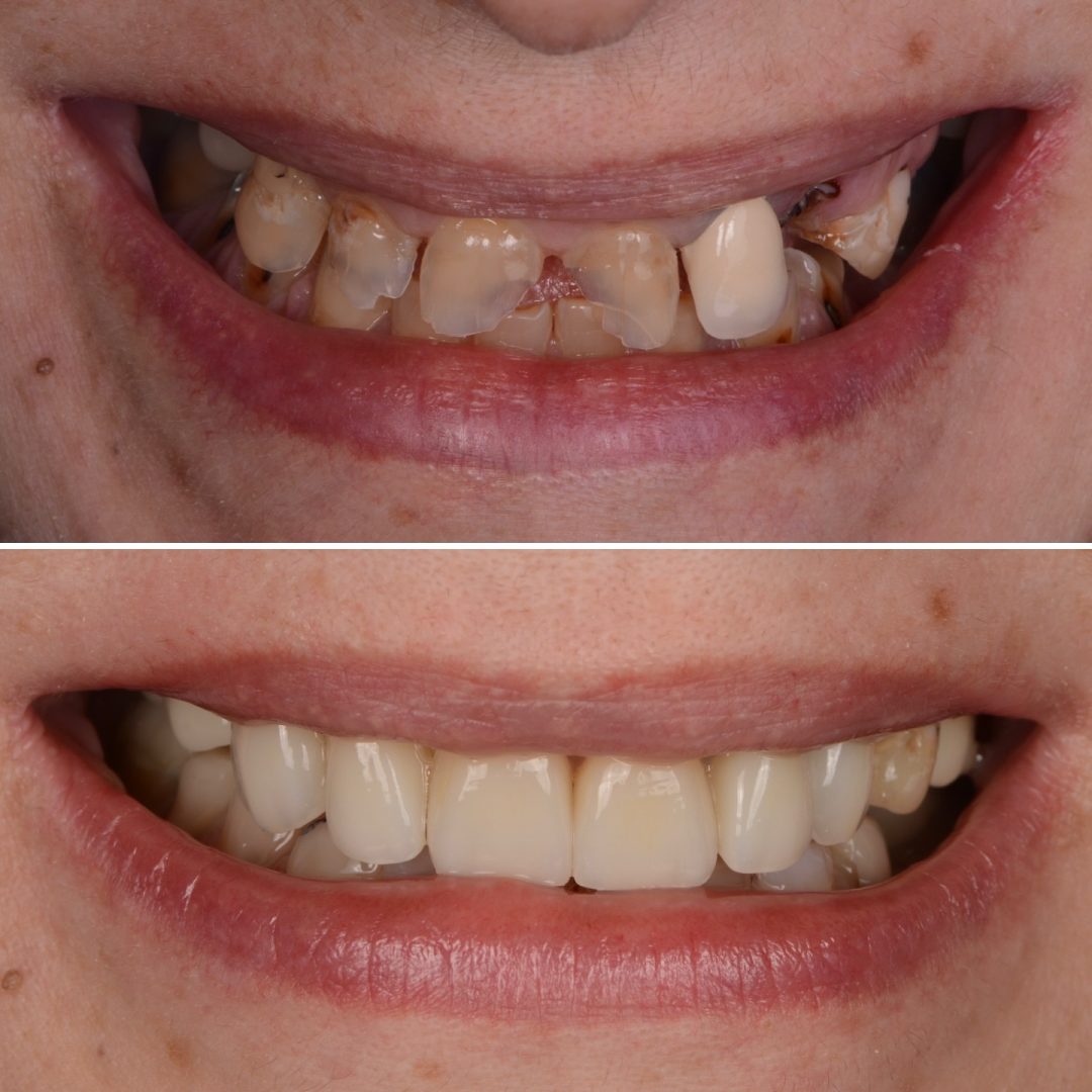 Metodo Aura prima e dopo (10)