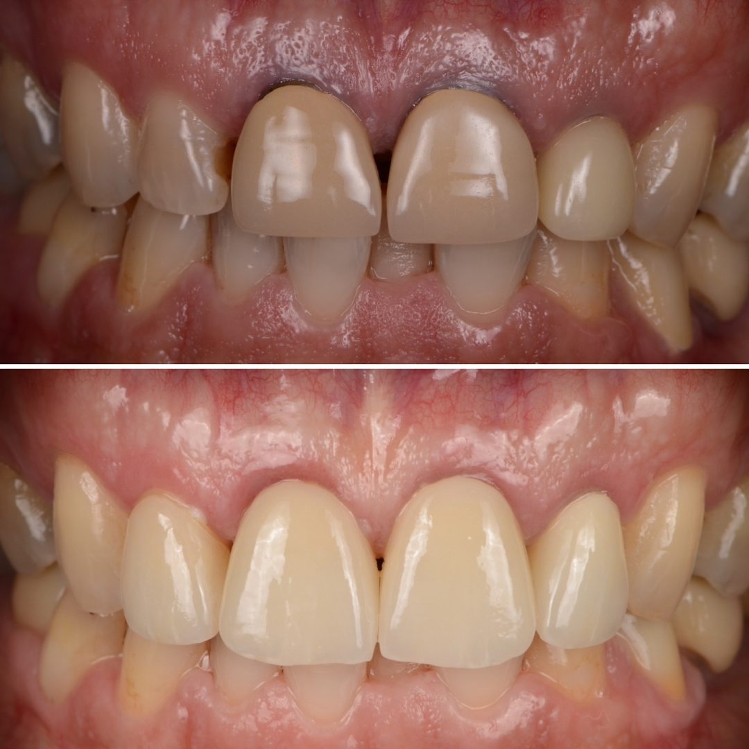 Metodo Aura prima e dopo (12)