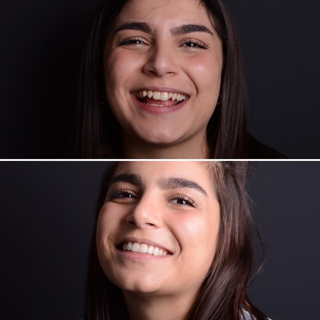 Metodo Aura prima e dopo (4)