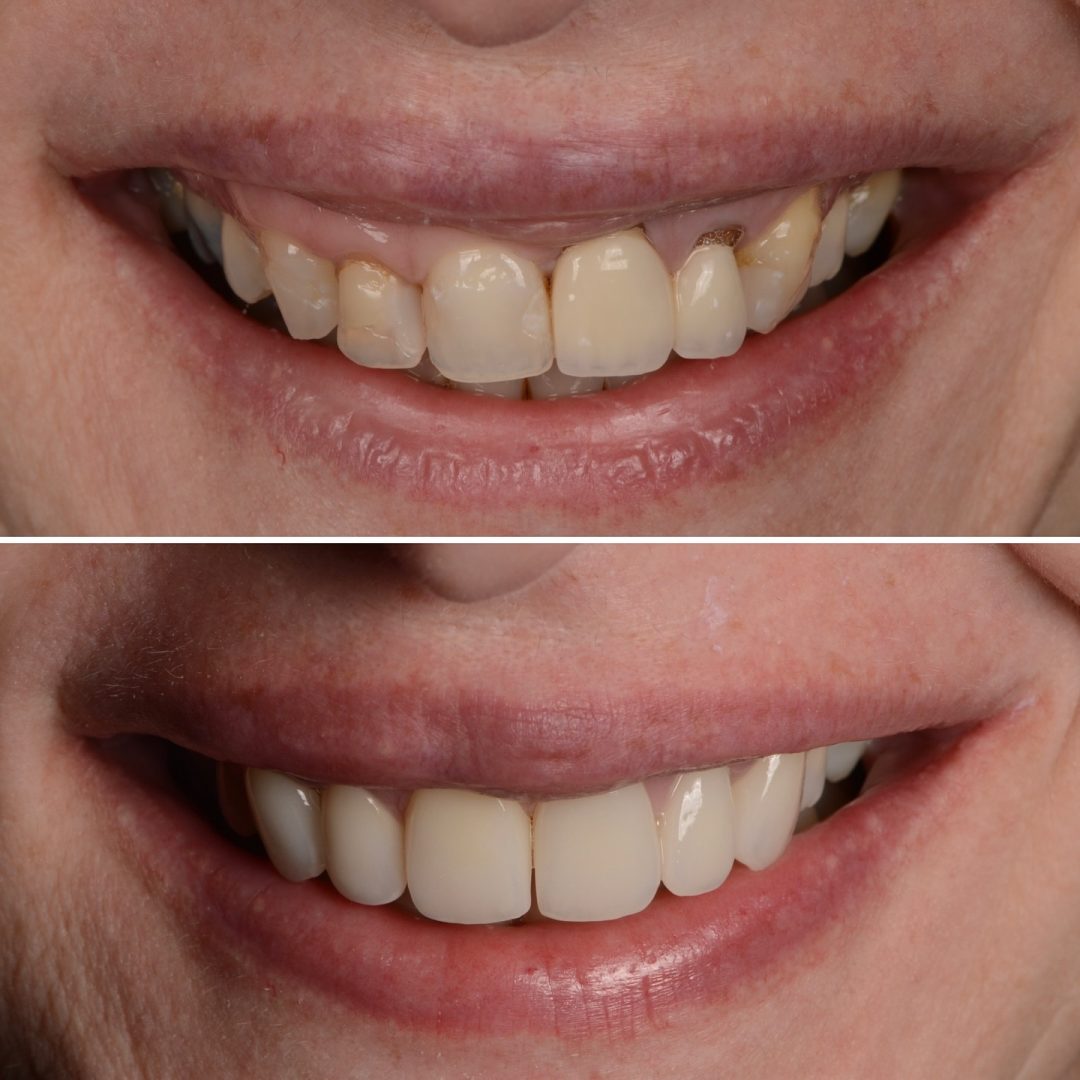 Metodo Aura prima e dopo (7)