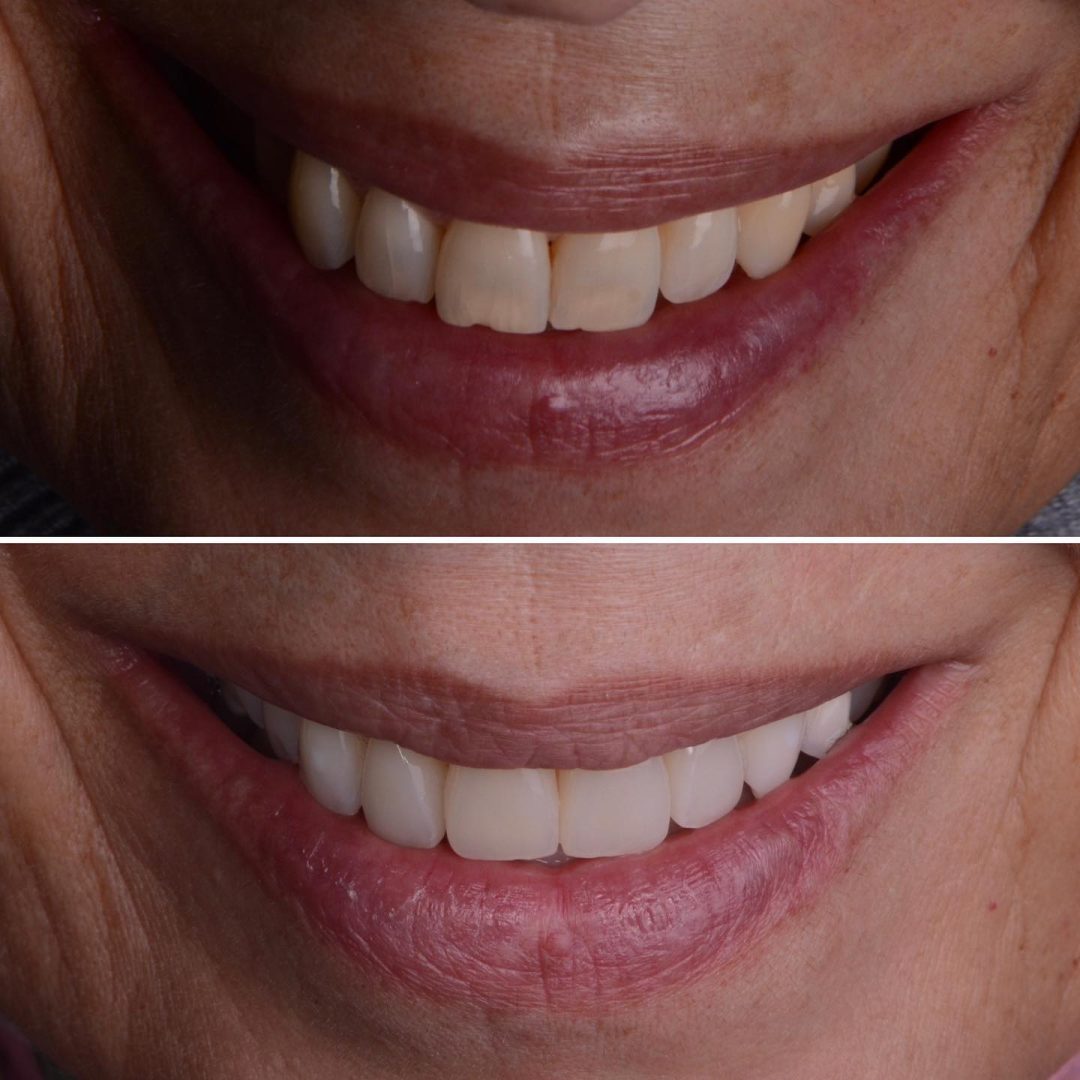 Metodo Aura prima e dopo (8)