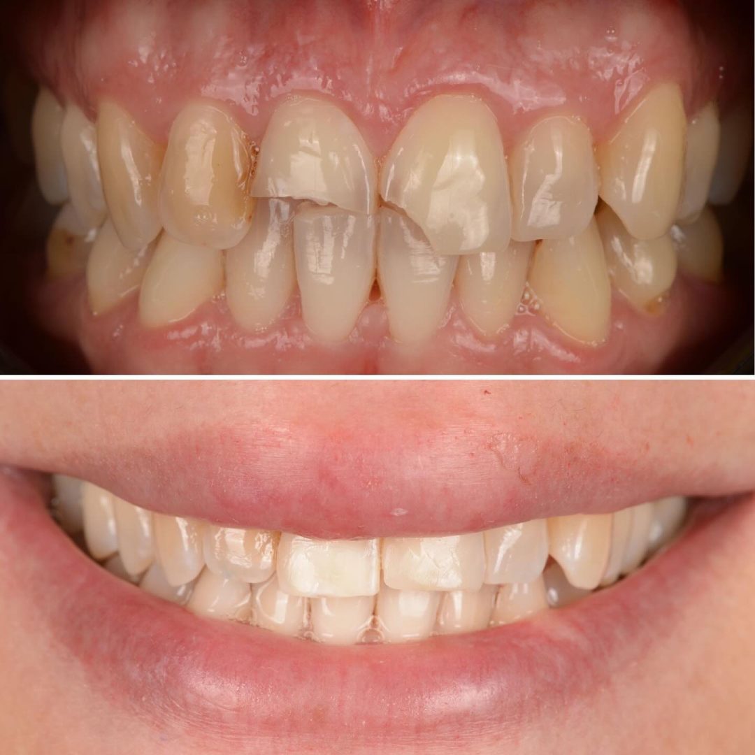 Metodo Aura prima e dopo (9)